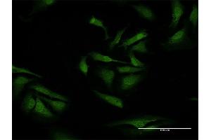 Immunofluorescence of purified MaxPab antibody to TXNDC9 on HeLa cell.