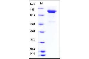 Image no. 1 for SLIT and NTRK-Like Family, Member 4 (SLITRK4) (AA 1-616) protein (His tag) (ABIN2005491)