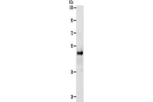Image no. 2 for anti-SRY (Sex Determining Region Y)-Box 8 (SOX8) antibody (ABIN2426907)