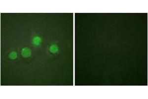 Immunofluorescence analysis of HuvEc cells, using GATA4 (Phospho-Ser262) Antibody.