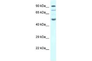 Western Blot showing SESN2 antibody used at a concentration of 1 ug/ml against Fetal Heart Lysate