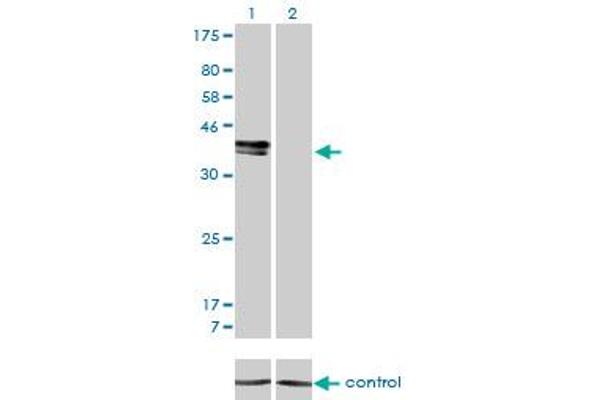 anti-ISL LIM Homeobox 1 (ISL1) (AA 63-159) antibody