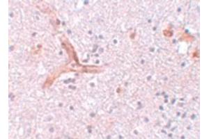 Image no. 2 for anti-Zinc Finger CCCH-Type Containing 12C (ZC3H12C) (N-Term) antibody (ABIN6656904)