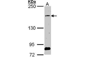 Image no. 3 for anti-Son of Sevenless Homolog 2 (SOS2) (Center) antibody (ABIN2855141)