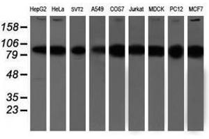 Image no. 6 for anti-Proteasome (Prosome, Macropain) 26S Subunit, Non-ATPase, 2 (PSMD2) antibody (ABIN1500479)