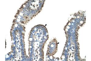 Image no. 9 for anti-Matrix Metallopeptidase 1 (Interstitial Collagenase) (MMP1) (N-Term) antibody (ABIN2777119)
