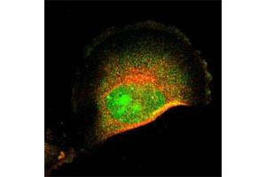Immunofluorescent staining of U-251MG cell line with antibody shows positivity in nucleus, nucleoli and cytosol (green).