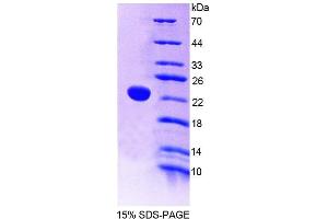 Image no. 1 for Protein tyrosine Phosphatase, Receptor Type, E (PTPRE) (AA 346-500) protein (T7 tag,His tag) (ABIN6239276)
