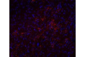Image no. 1 for anti-Solute Carrier Family 17 (Sodium-Dependent Inorganic Phosphate Cotransporter), Member 8 (SLC17A8) (AA 543-601), (C-Term) antibody (ABIN1742302)