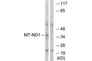 Image no. 2 for anti-Mitochondrially Encoded NADH Dehydrogenase 1 (MT-ND1) (AA 176-225) antibody (ABIN1535071)