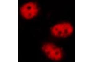 Image no. 1 for anti-Signal Transducer and Activator of Transcription 3 (Acute-Phase Response Factor) (STAT3) (pTyr705) antibody (ABIN6255995)