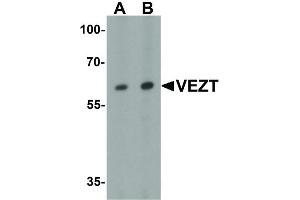 anti-Vezatin, Adherens Junctions Transmembrane Protein (VEZT) (Internal Region) antibody