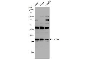 Image no. 1 for anti-Methylthioadenosine phosphorylase (MTAP) (full length) antibody (ABIN2856653)