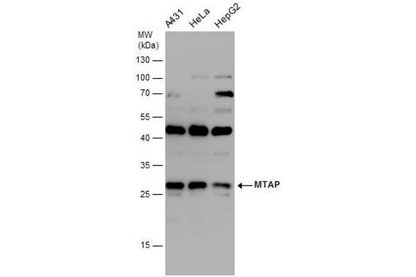 anti-Methylthioadenosine phosphorylase (MTAP) (full length) antibody
