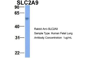 Image no. 2 for anti-Solute Carrier Family 2 (Facilitated Glucose Transporter), Member 9 (SLC2A9) (Middle Region) antibody (ABIN2781547)
