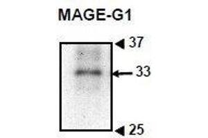 Image no. 2 for anti-Necdin-Like 2 (NDNL2) (AA 1-279) antibody (ABIN2452046)