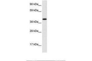 Image no. 1 for anti-Insulinoma-Associated 1 (INSM1) (AA 191-240) antibody (ABIN202692)