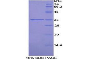 Image no. 1 for Proto-Oncogene Pim-2 (Serine Threonine Kinase) (PIM2) (AA 34-292) protein (His tag,T7 tag) (ABIN1877932)