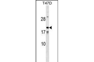 TN Antibody (N-term) (ABIN1538990 and ABIN2849412) western blot analysis in T47D cell line lysates (35 μg/lane).