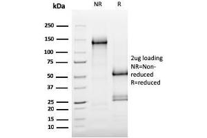 Image no. 1 for anti-C-Mer Proto-Oncogene Tyrosine Kinase (MERTK) (AA 55-148) antibody (ABIN6939061)