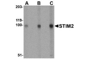 Image no. 1 for anti-Stromal Interaction Molecule 2 (Stim2) (Middle Region) antibody (ABIN318882)