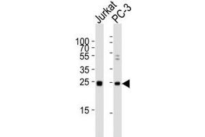 Image no. 2 for anti-High Mobility Group Box 4 (HMGB4) (AA 45-73) antibody (ABIN3031203)