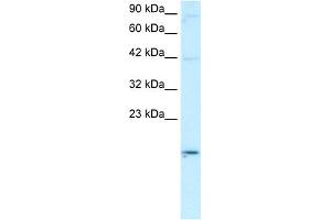 Image no. 1 for anti-Apolipoprotein B mRNA Editing Enzyme, Catalytic Polypeptide-Like 3G (APOBEC3G) (N-Term) antibody (ABIN2777994)