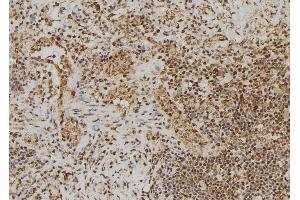 Image no. 2 for anti-Breast Cancer 2, Early Onset (BRCA2) (pSer2095) antibody (ABIN6270046)