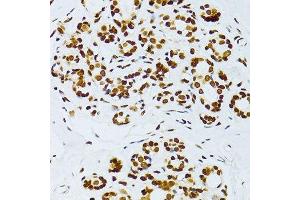 Image no. 6 for anti-Nuclear Factor-kB p65 (NFkBP65) (pSer276) antibody (ABIN1682005)