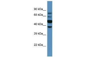 Image no. 1 for anti-Wingless-Type MMTV Integration Site Family, Member 6 (WNT6) (Middle Region) antibody (ABIN2782720)