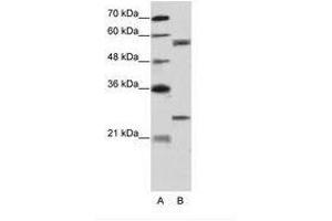 Image no. 2 for anti-Copine I (CPNE1) (AA 75-124) antibody (ABIN203200)