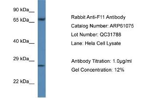 Image no. 1 for anti-Coagulation Factor XI (F11) (C-Term) antibody (ABIN2788664)