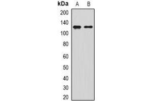 Image no. 2 for anti-Sirtuin 1 (SIRT1) antibody (ABIN6006096)