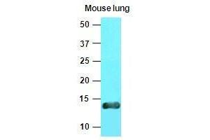 Image no. 1 for anti-Vesicle-Associated Membrane Protein 3 (VAMP3) (AA 1-77) antibody (ABIN933073)