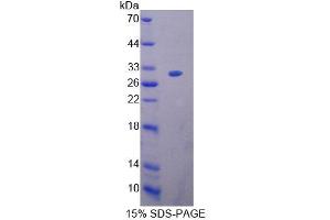 Image no. 1 for BCL2-Associated Athanogene (BAG1) (AA 149-345) protein (His tag) (ABIN6239584)