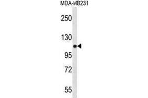 Image no. 2 for anti-Actinin, alpha 3 (ACTN3) (AA 408-437), (Middle Region) antibody (ABIN950371)