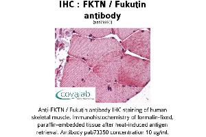 Image no. 1 for anti-Fukutin (FKTN) (AA 272-456) antibody (ABIN1734362)