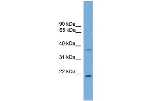 Image no. 1 for anti-Glutathione S-Transferase mu 1 (GSTM1) (C-Term) antibody (ABIN2776985)