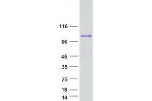 Image no. 1 for Sec23 Homolog B (SEC23B) (Transcript Variant 3) protein (Myc-DYKDDDDK Tag) (ABIN2731572)