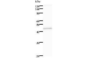 Image no. 1 for anti-serine/threonine Kinase 38 Like (STK38L) antibody (ABIN931250)