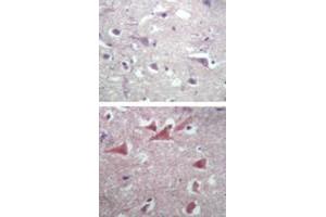 Image no. 1 for anti-Tubulin, beta 2A (TUBB2A) antibody (ABIN537530)