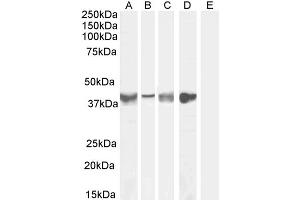 Image no. 2 for anti-Asporin (ASPN) (Internal Region) antibody (ABIN185364)