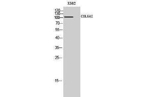 Image no. 1 for anti-Collagen, Type VI, alpha 2 (COL6A2) (Internal Region) antibody (ABIN3184023)