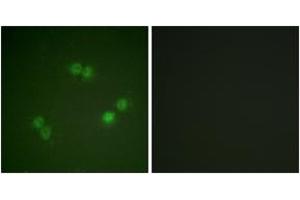 Image no. 2 for anti-Splicing Factor 1 (SF1) (AA 48-97), (pSer82) antibody (ABIN1531391)