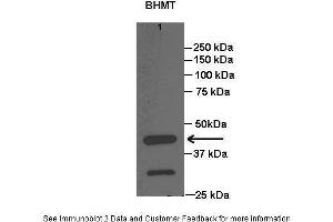 Image no. 3 for anti-Betaine--Homocysteine S-Methyltransferase (BHMT) (C-Term) antibody (ABIN2776836)