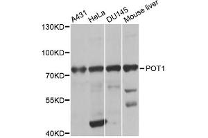 Image no. 1 for anti-Protection of Telomeres 1 (POT1) antibody (ABIN6568518)