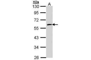 Image no. 1 for anti-Flavin Containing Monooxygenase 2 (Non-Functional) (FMO2) (Center) antibody (ABIN2856714)