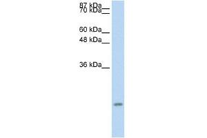 Image no. 1 for anti-Chemokine (C-C Motif) Ligand 13 (CCL13) (Middle Region) antibody (ABIN926919)