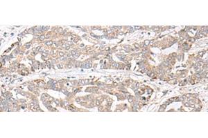 CHST4 antibody