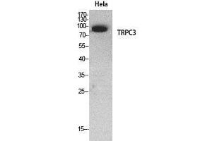 Image no. 5 for anti-Transient Receptor Potential Cation Channel, Subfamily C, Member 3 (TRPC3) (Internal Region) antibody (ABIN3187992)
